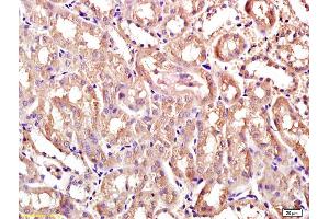 Formalin-fixed and paraffin embedded rat kidney labeled with Anti-Ceramide synthase 2 Polyclonal Antibody, Unconjugated (ABIN709331) at 1:200 followed by conjugation to the secondary antibody and DAB staining (Ceramide Synthase 2 antibody  (AA 201-300))