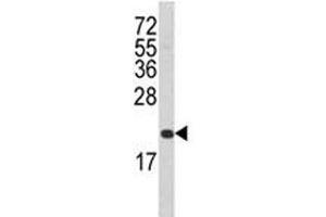 Western blot analysis of FAS antibody and T47D lysate. (FAS antibody  (AA 185-211))