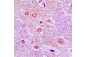 Immunohistochemical analysis of SYT staining in human brain formalin fixed paraffin embedded tissue section. (SS18 antibody  (N-Term))