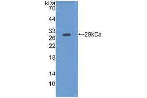 Detection of Recombinant FBLN3, Human using Monoclonal Antibody to Fibulin 3 (FBLN3) (FBLN3 antibody  (AA 258-493))