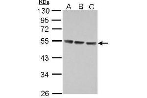 WB Image Sample (30 ug of whole cell lysate) A: Jurkat B: Raji C: K562 10% SDS PAGE antibody diluted at 1:5000 (IL13 Receptor alpha 1 antibody)