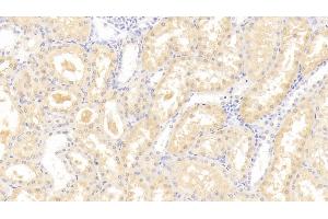 Immunohistochemistry (IHC) image for anti-Leptin Receptor (LEPR) (AA 310-539) antibody (ABIN7430873)