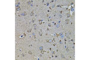 Immunohistochemistry of paraffin-embedded mouse brain using FDX1 antibody. (Ferredoxin1 (FDX1) antibody)