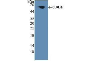 Western blot analysis of recombinant Human PKCq. (PKC theta antibody  (AA 380-634))