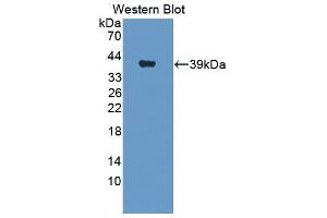 Western Blotting (WB) image for anti-Insulin Receptor (INSR) (AA 1027-1364) antibody (ABIN1859482) (Insulin Receptor antibody  (AA 1027-1364))