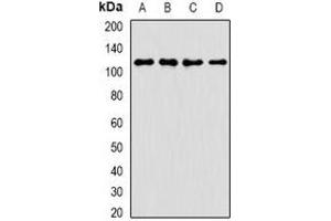 Western blot analysis of ANR52 expression in A549 (A), K562 (B), mouse brain (C), rat liver (D) whole cell lysates.
