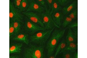 IF analysis of U1-C/SNRPC and Tubulin beta using anti-U1-C/SNRPC antibody (ABIN7599016) and anti-Tubulin beta antibody (ABIN7602744). (SNRPC antibody  (AA 1-159))