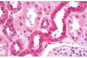 Anti-FIH / CASR antibody IHC staining of human kidney, tubules.
