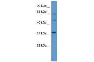 WB Suggested Anti-MKNK1 Antibody Titration: 0. (MKNK1 antibody  (C-Term))