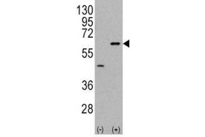 Western Blotting (WB) image for anti-V-Akt Murine Thymoma Viral Oncogene Homolog 3 (Protein Kinase B, Gamma) (AKT3) (AA 450-479) antibody (ABIN3029478)