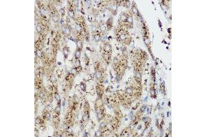 Immunohistochemistry of paraffin-embedded Rat cartilage using Aggrecan Rabbit pAb (ABIN6127417, ABIN6136406, ABIN6136408 and ABIN6224631) at dilution of 1:50 (40x lens). (Aggrecan antibody  (AA 20-280))