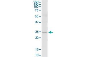 TMED5 MaxPab polyclonal antibody. (TMED5 antibody  (AA 1-229))