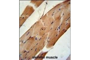 CNO6L Antibody (C-term) (ABIN651400 and ABIN2840217) immunohistochemistry analysis in formalin fixed and paraffin embedded human skeletal muscle followed by peroxidase conjugation of the secondary antibody and DAB staining. (CNOT6L antibody  (C-Term))