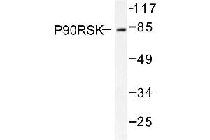 Image no. 1 for anti-Ribosomal Protein S6 Kinase, 90kDa, Polypeptide 1 (RPS6KA1) antibody (ABIN271934) (RPS6KA1 antibody)