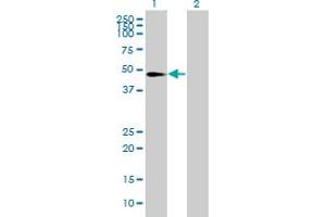 Western Blot analysis of PYGO1 expression in transfected 293T cell line by PYGO1 MaxPab polyclonal antibody. (PYGO1 antibody  (AA 1-419))