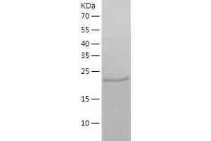 Glutathione S-Transferase mu 1 (GSTM1) (AA 1-218) protein (His-IF2DI Tag)