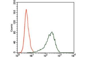 Immunohistochemical analysis of paraffin-embedded ovarian cancer tissues using SRY antibody with DAB staining. (SRY antibody  (AA 1-204))