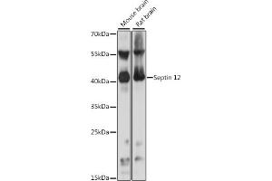 Western blot analysis of extracts of various cell lines, using Septin 12 antibody (ABIN7265307) at 1:1000 dilution. (Septin 12 antibody  (AA 189-358))