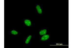 Immunofluorescence of purified MaxPab antibody to ERCC8 on HeLa cell. (ERCC8 antibody  (AA 1-396))