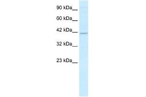 RFP2 antibody (20R-1084) used at 2. (TRIM13 antibody  (Middle Region))
