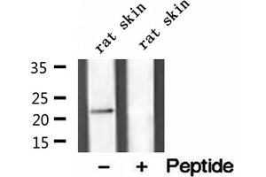 Western blot analysis of extracts of rat skin tissue, using Dermatopontin antibody. (Dermatopontin antibody  (Internal Region))