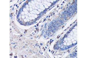 Immunohistochemistry of paraffin-embedded Human colon using NLRC4 Polyclonal Antibody at dilution of 1:100 (40x lens).