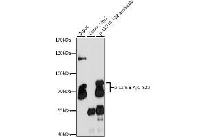 Immunoprecipitation analysis of 200 μg extracts of HeLa cells, using 3 μg Phospho-Lamin A/C-S22 pAb (ABIN6135255, ABIN6136134, ABIN6136135 and ABIN6225675). (Lamin A/C antibody  (pSer22))