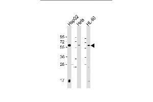 PI4K2A antibody  (C-Term)