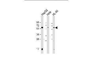 All lanes : Anti-PI4K2A Antibody (C-term) at 1:2000 dilution Lane 1: HepG2 whole cell lysate Lane 2: Hela whole cell lysate Lane 3: HL-60 whole cell lysate Lysates/proteins at 20 μg per lane.