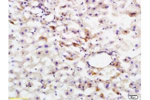 Formalin-fixed and paraffin embedded rat liver tissue labeled with Anti-phospho-HMGCR(Ser872) Polyclonal Antibody, Unconjugated (ABIN753283) at 1:200 followed by conjugation to the secondary antibody and DAB staining