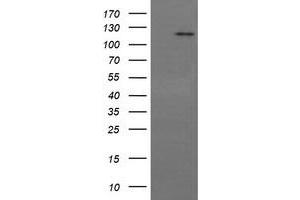 Image no. 6 for anti-PTK2 Protein tyrosine Kinase 2 (PTK2) antibody (ABIN1498193) (FAK antibody)