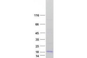 Validation with Western Blot (FXYD3 Protein (Transcript Variant 7) (Myc-DYKDDDDK Tag))