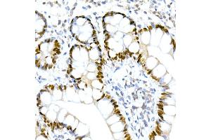 Immunohistochemistry of paraffin-embedded human small intestine using HNF-4-alpha Rabbit mAb (ABIN7267621) at dilution of 1:150 (40x lens).