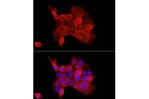 Immunofluorescence analysis of  cells using CDH3 Rabbit pAb (ABIN7269142) at dilution of 1:100 (40x lens). (P-Cadherin antibody  (AA 24-350))