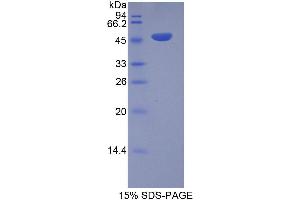 SDS-PAGE (SDS) image for Inducible T-Cell Co-Stimulator (ICOS) (AA 31-190) protein (His tag,GST tag) (ABIN2123005)