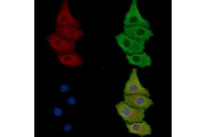ABIN7095808 and ABIN7099870 staining HepG2 cells by IF/ICC. (SEL1L antibody)