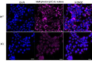 anti-Methylmalonyl Coenzyme A Mutase (MUT) antibody