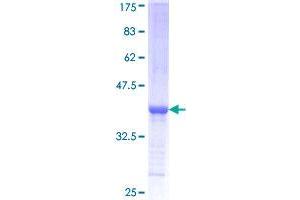 SPTLC2 Protein (AA 453-561) (GST tag)
