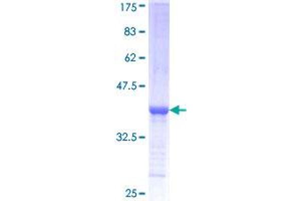 SPTLC2 Protein (AA 453-561) (GST tag)