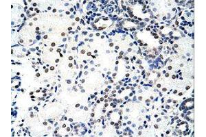 Image no. 2 for anti-Nucleolin (NCL) (C-Term) antibody (ABIN202879)