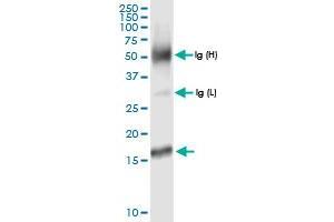 Immunoprecipitation of MTP18 transfected lysate using anti-MTP18 MaxPab rabbit polyclonal antibody and Protein A Magnetic Bead , and immunoblotted with MTP18 MaxPab rabbit polyclonal antibody (D01) . (Mtfp1 antibody  (AA 1-166))