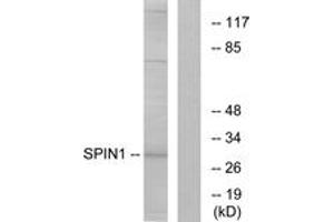 Western blot analysis of extracts from HeLa cells, using SPIN1 Antibody. (Spindlin 1 antibody  (AA 111-160))