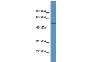 WB Suggested Anti-ARHGAP19 AntibodyTitration: 1. (ARHGAP19 antibody  (C-Term))