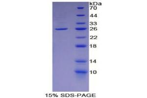 SDS-PAGE (SDS) image for Lumican (LUM) (AA 19-338) protein (His tag) (ABIN1099258) (LUM Protein (AA 19-338) (His tag))