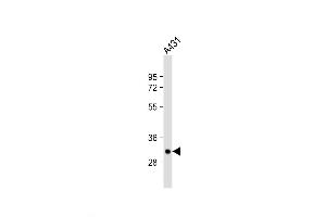 Western Blot at 1:1000 dilution + A431 whole cell lysate Lysates/proteins at 20 ug per lane. (TPSAB1 antibody  (AA 61-87))