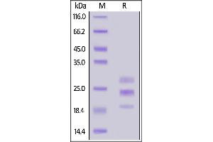 Cynomolgus IL-17A, His Tag on  under reducing (R) condition. (Interleukin 17a Protein (AA 24-155) (His tag))