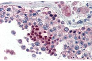 Immunohistochemistry (IHC) image for anti-Nuclear Receptor Subfamily 0, Group B, Member 1 (NR0B1) (Middle Region) antibody (ABIN2777385)