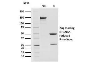 SDS-PAGE Analysis Purified STAT2 Mouse Monoclonal Antibody (STAT2/2650). (STAT2 antibody)