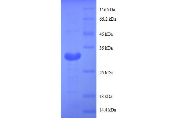 MT1G Protein (AA 1-59, partial) (GST tag)