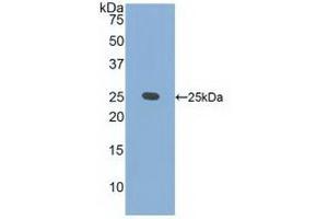 Western blot analysis of recombinant Human CRADD. (CRADD antibody  (AA 1-199))